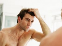 Comment Faire Face A La Perte de Cheveux Pour Hommes Avec Har Vokse